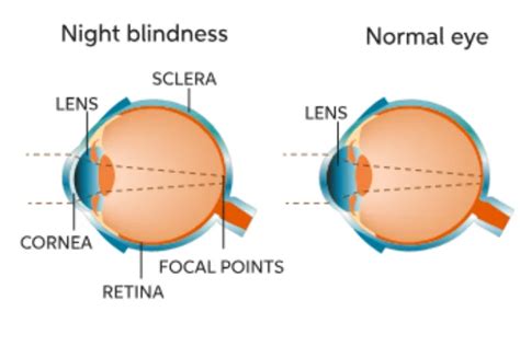 Night Blindness - A Literary Odyssey Exploring Trauma and the Power of Memory!